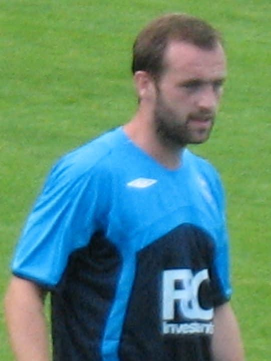 James McFadden - Athlete hair transplant