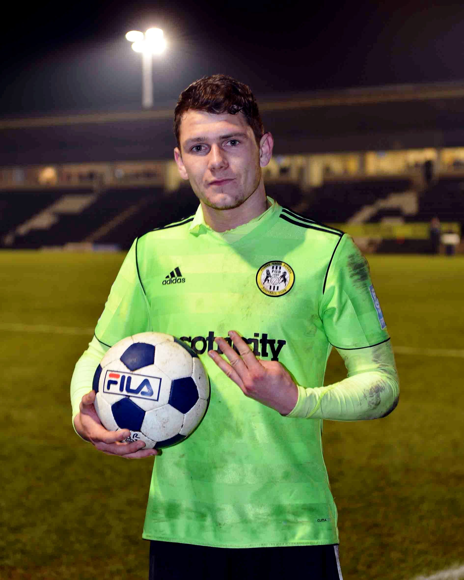 James Norwood - Athlete hair transplant