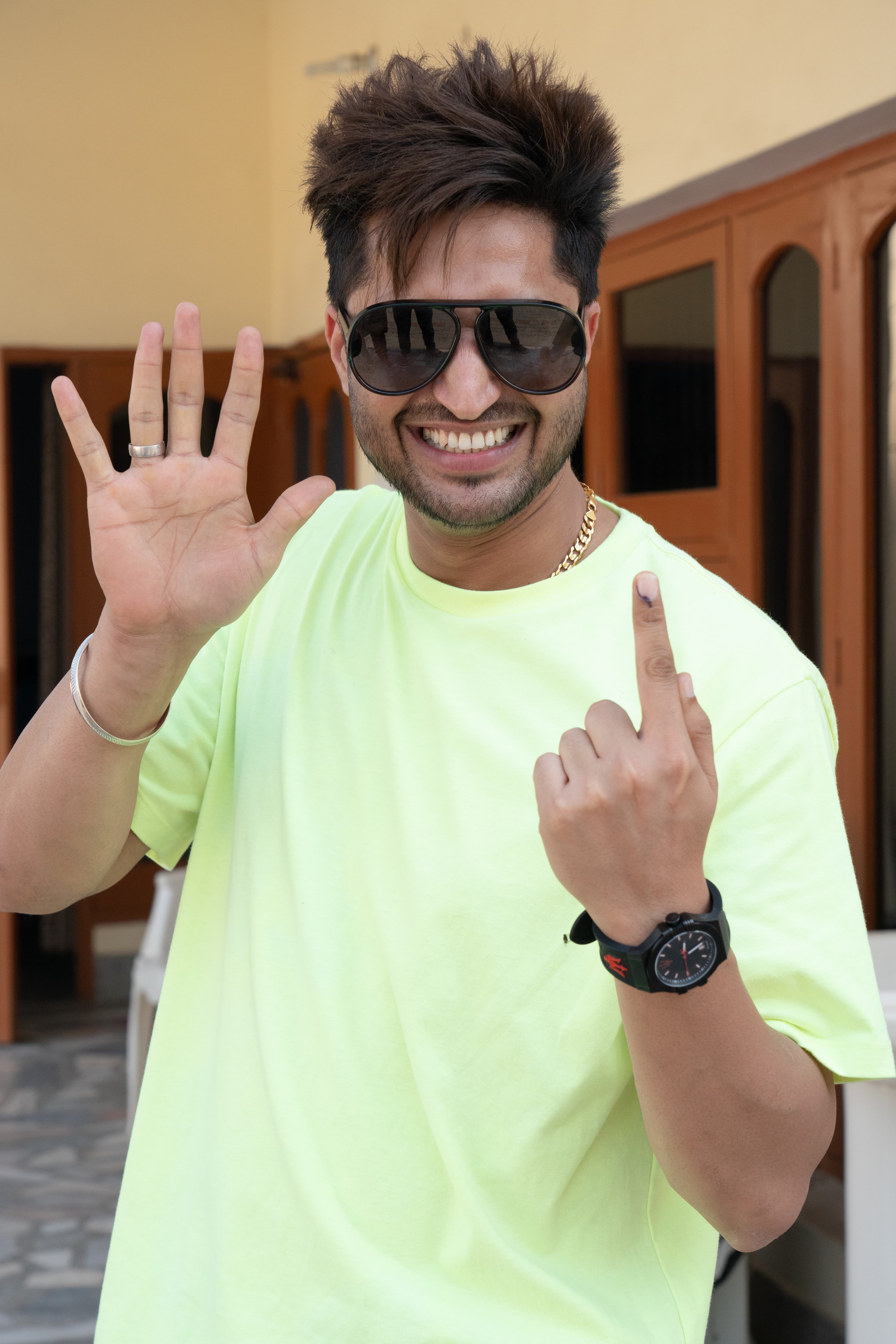 Jassie Gill - Actor hair transplant