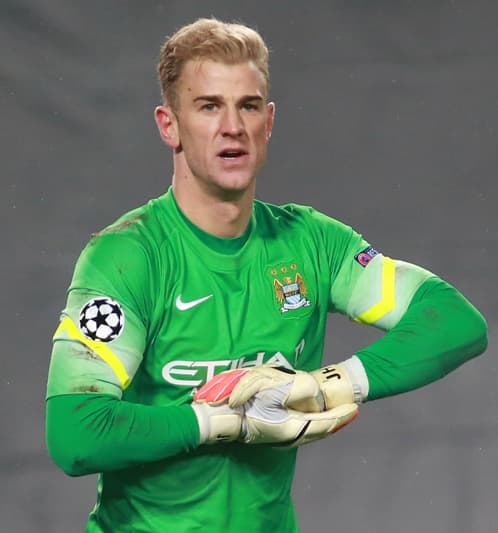 Joe Hart - Athlete hair transplant