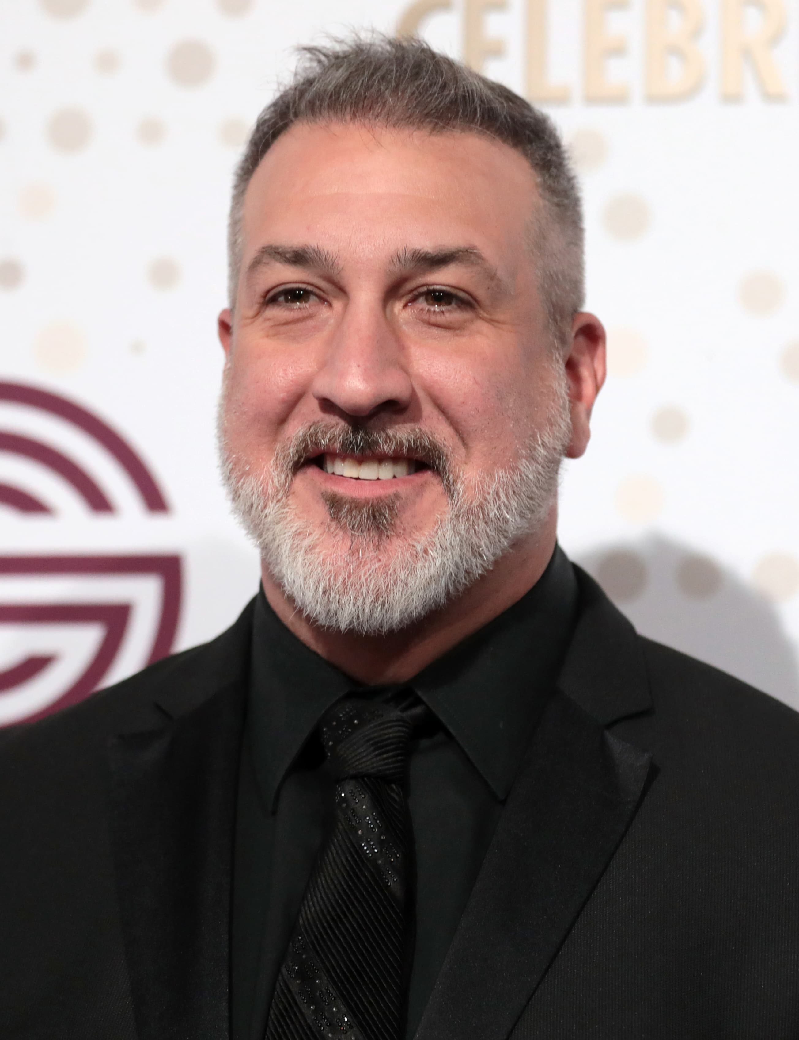 Joey Fatone - Musician with confirmed hair transplant