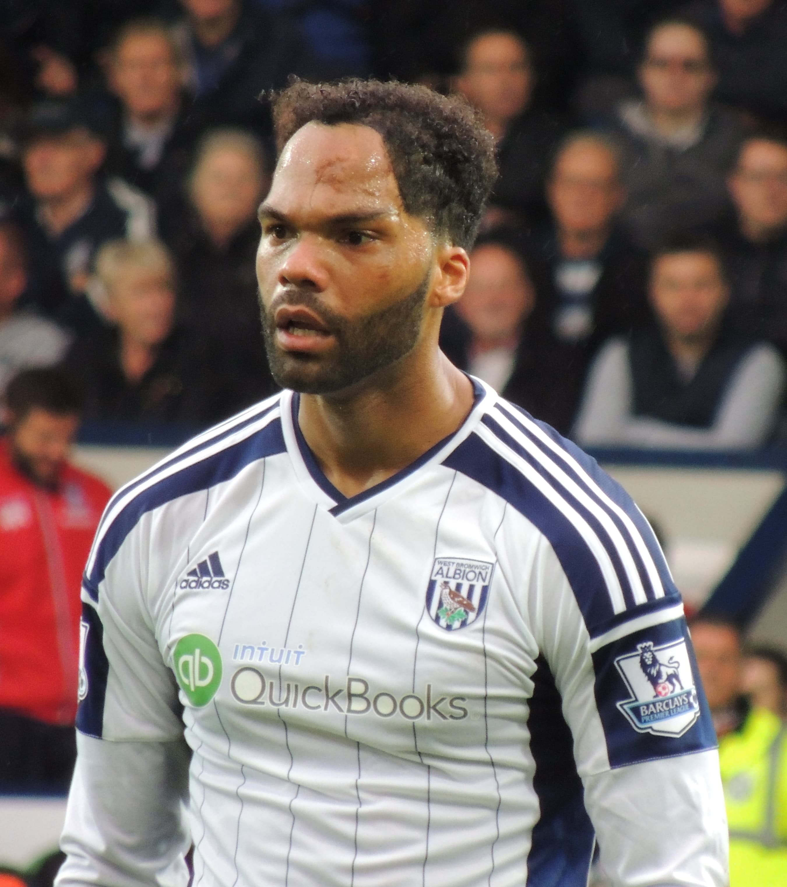 Joleon Lescott - Athlete hair transplant