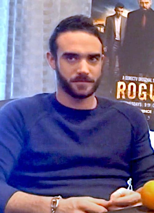 Joshua Sasse - Actor hair transplant