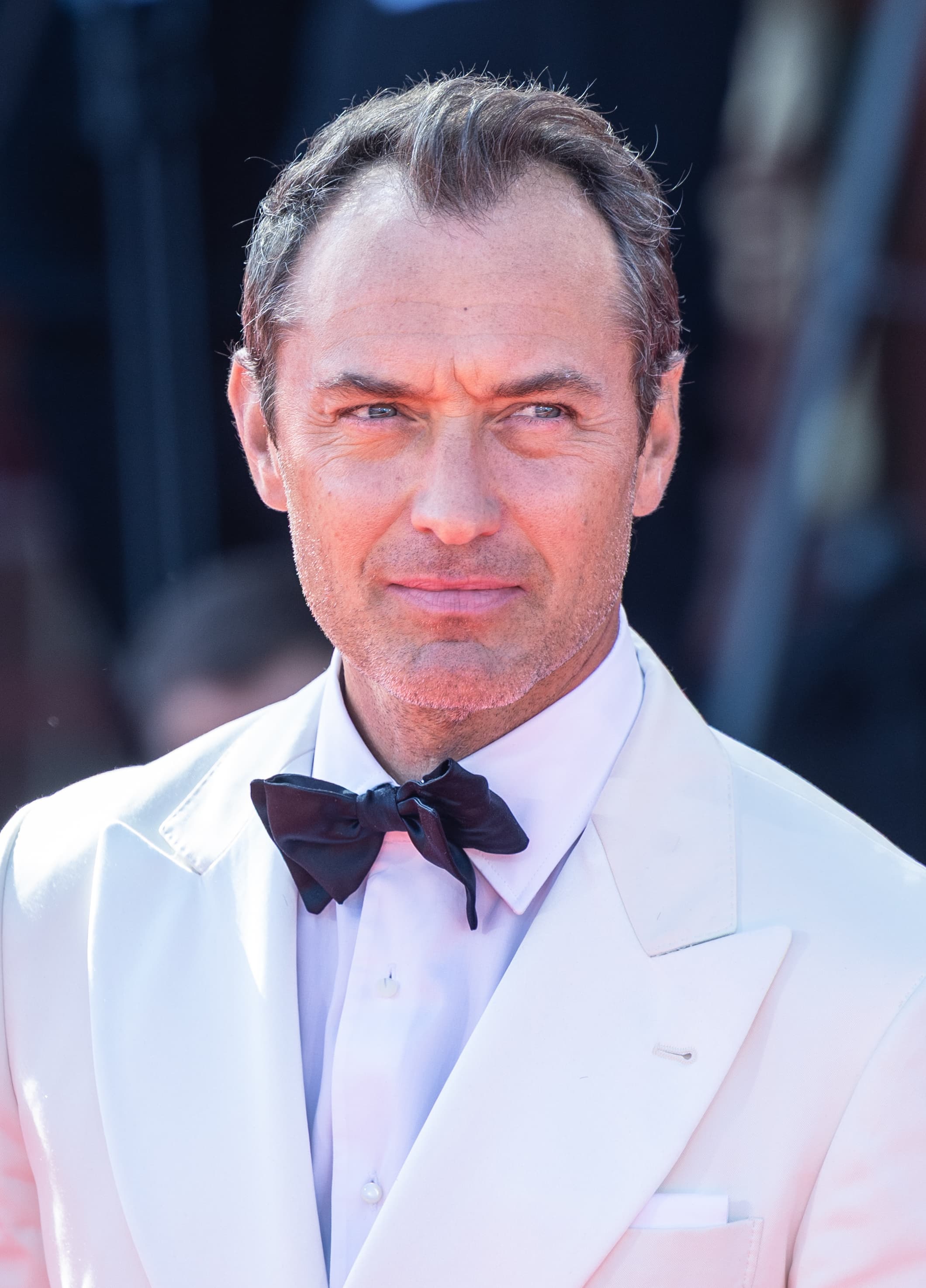 Jude Law - Actor hair transplant