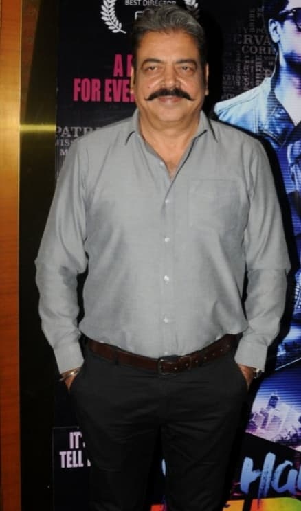 Karmveer Choudhary - Actor hair transplant