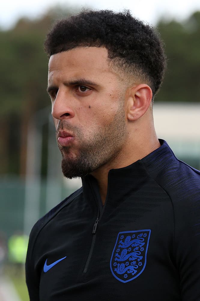 Kyle Walker - Athlete hair transplant