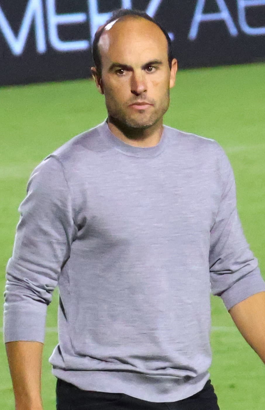 Landon Donovan - Athlete hair transplant