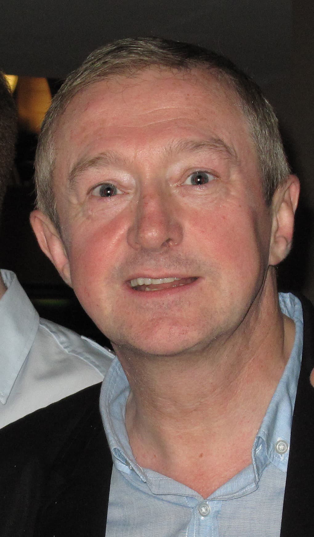 Louis Walsh - TV Personality with confirmed hair transplant