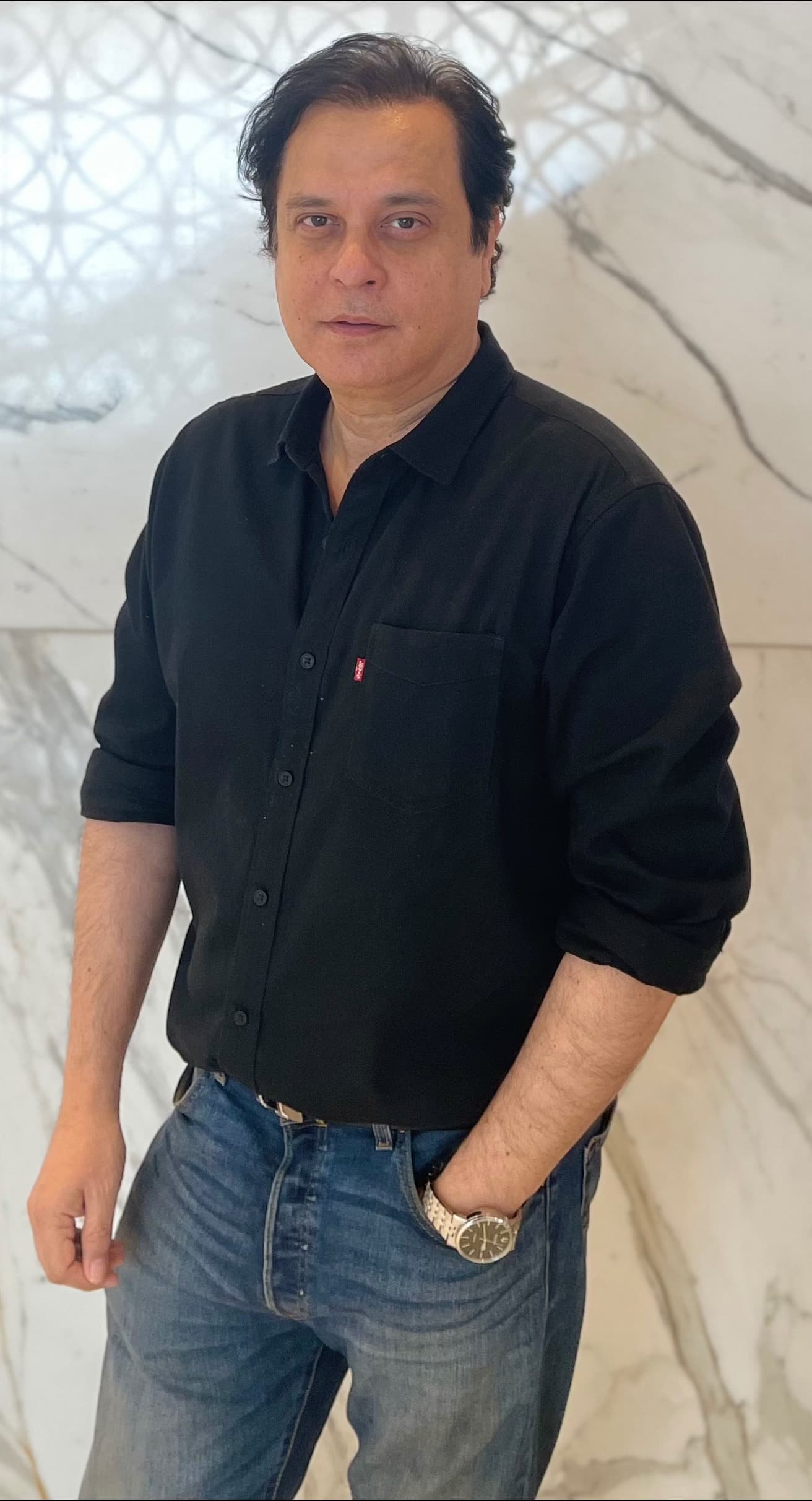 Mahesh Thakur - Actor hair transplant