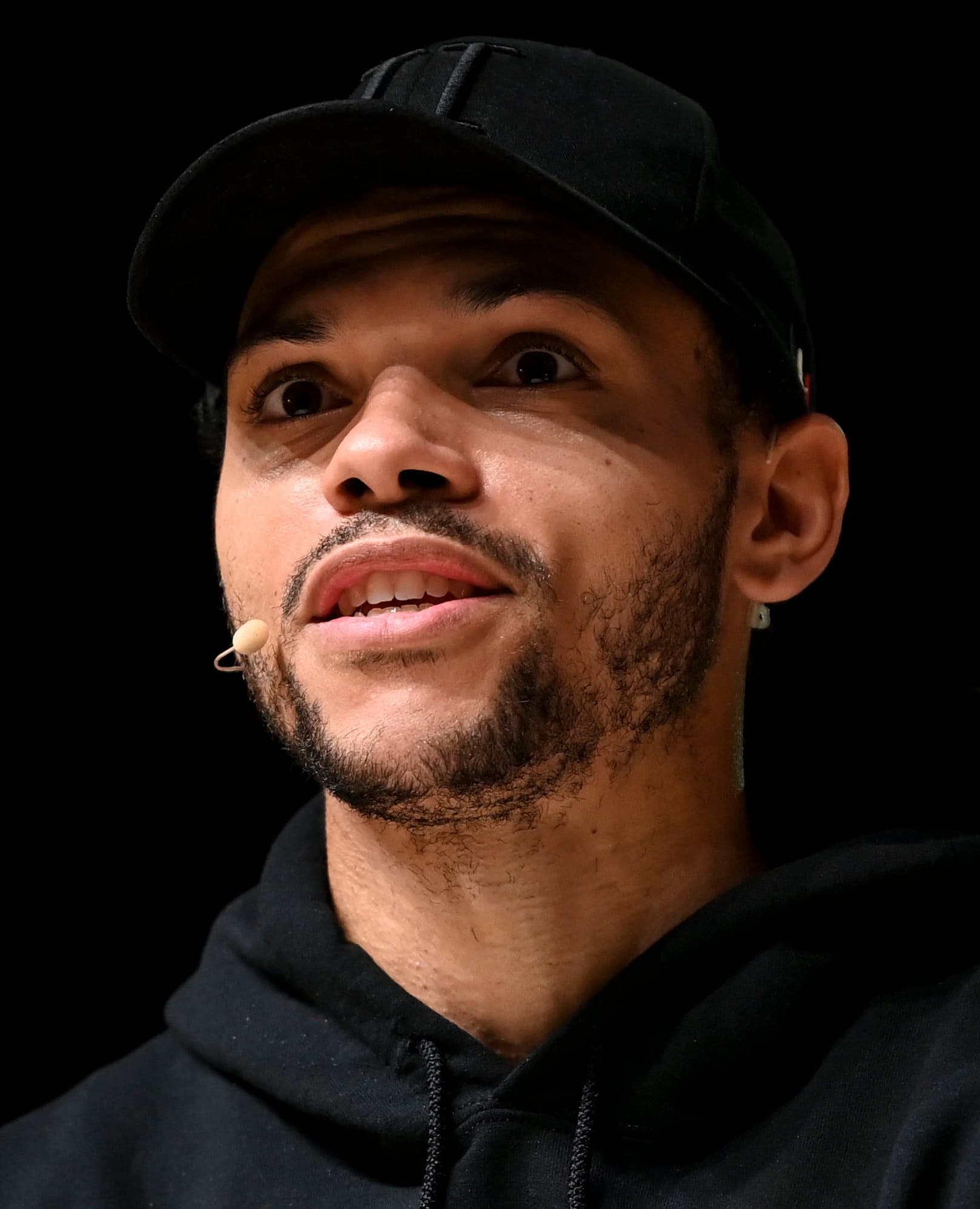 Martin Braithwaite - Athlete hair transplant