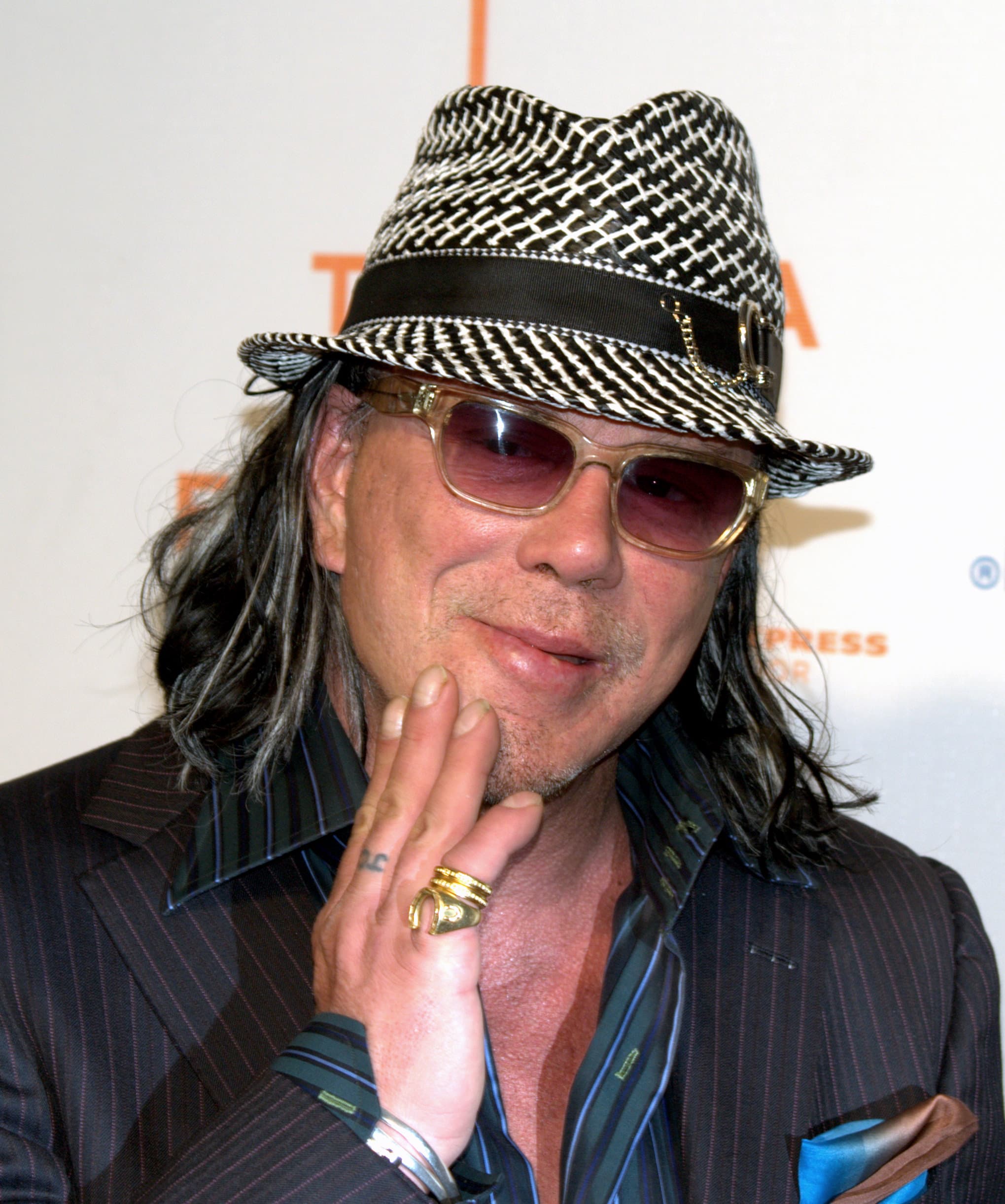 Mickey Rourke - Actor hair transplant