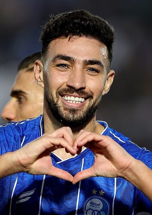 Munir El Haddadi - Athlete hair transplant