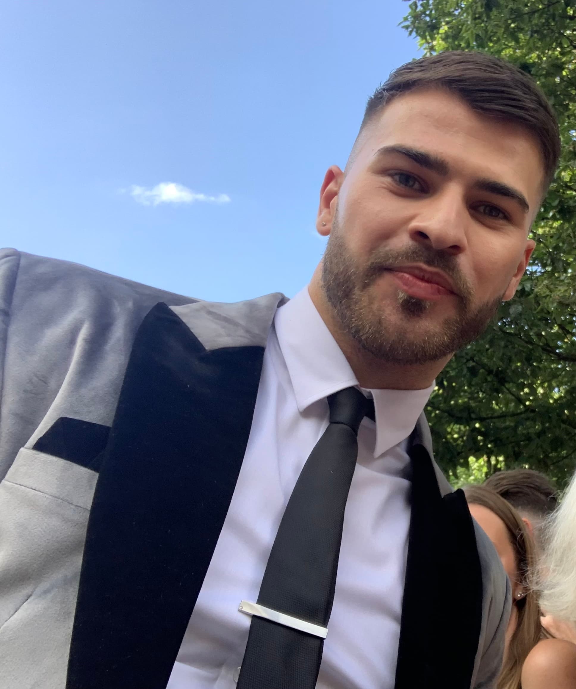 Owen Warner - Actor hair transplant