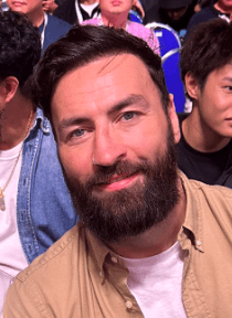 Paul Craig - Athlete hair transplant