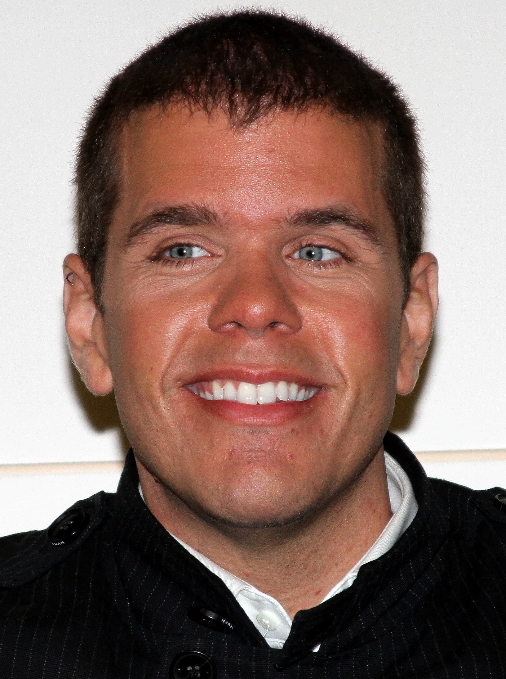 Perez Hilton - Content Creator hair transplant