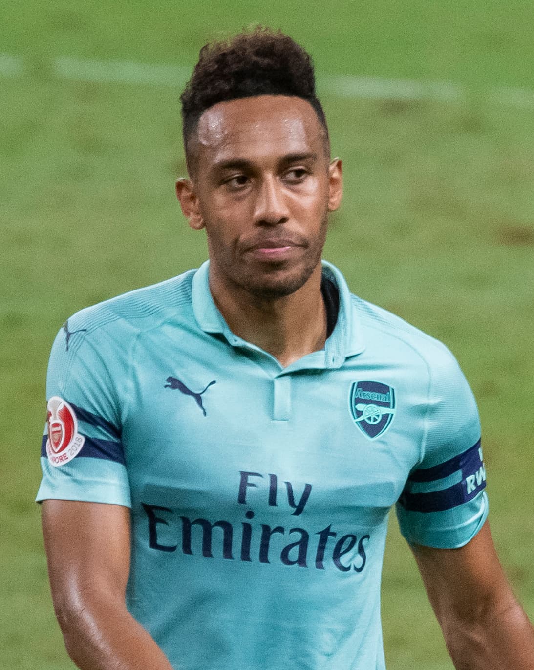 Pierre-Emerick Aubameyang - Athlete hair transplant