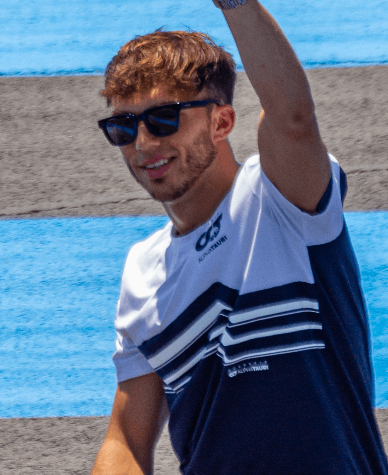Pierre Gasly - Athlete hair transplant