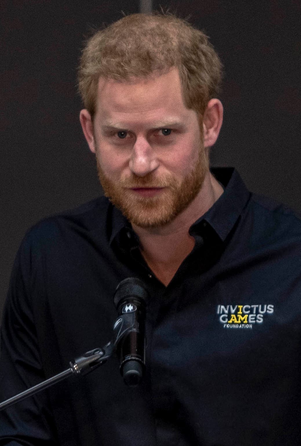 Prince Harry - Public Figure hair transplant