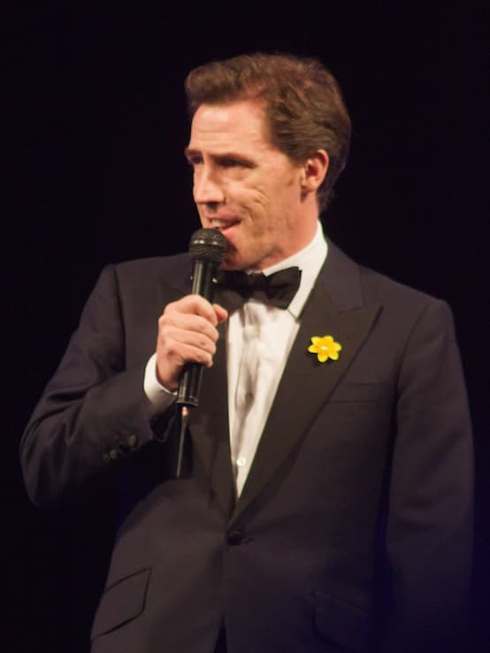 Rob Brydon - Actor hair transplant