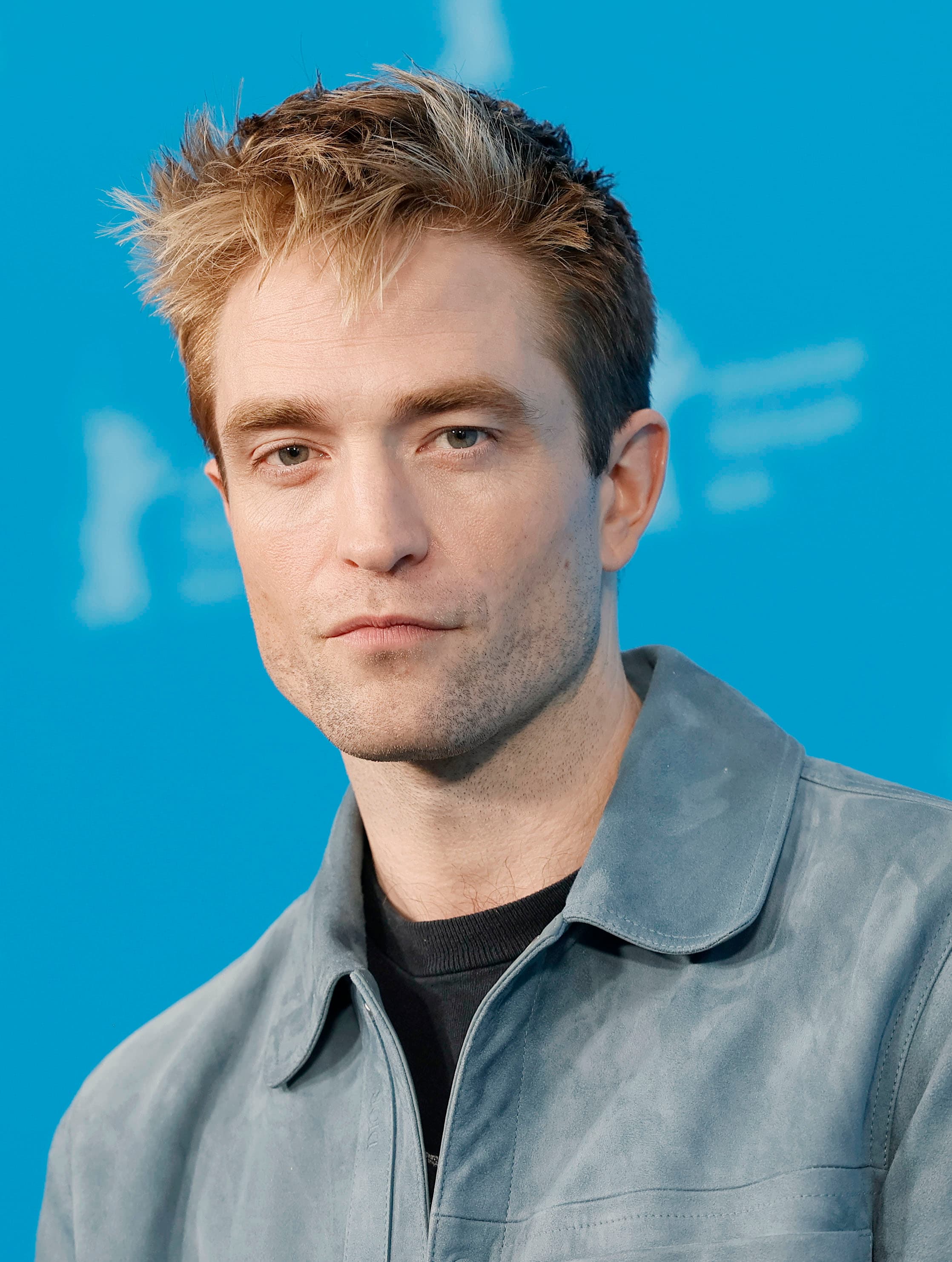 Robert Pattinson - Actor hair transplant