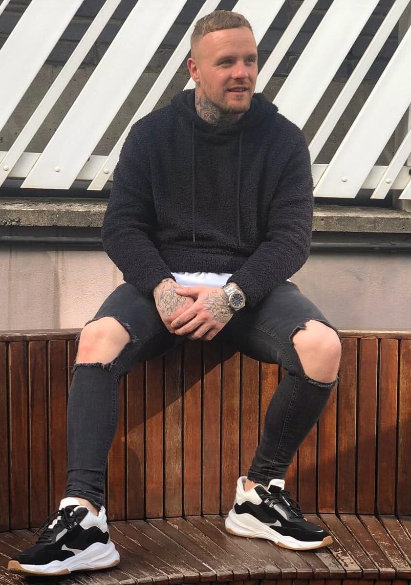 Ryan Tricks - TV Personality hair transplant