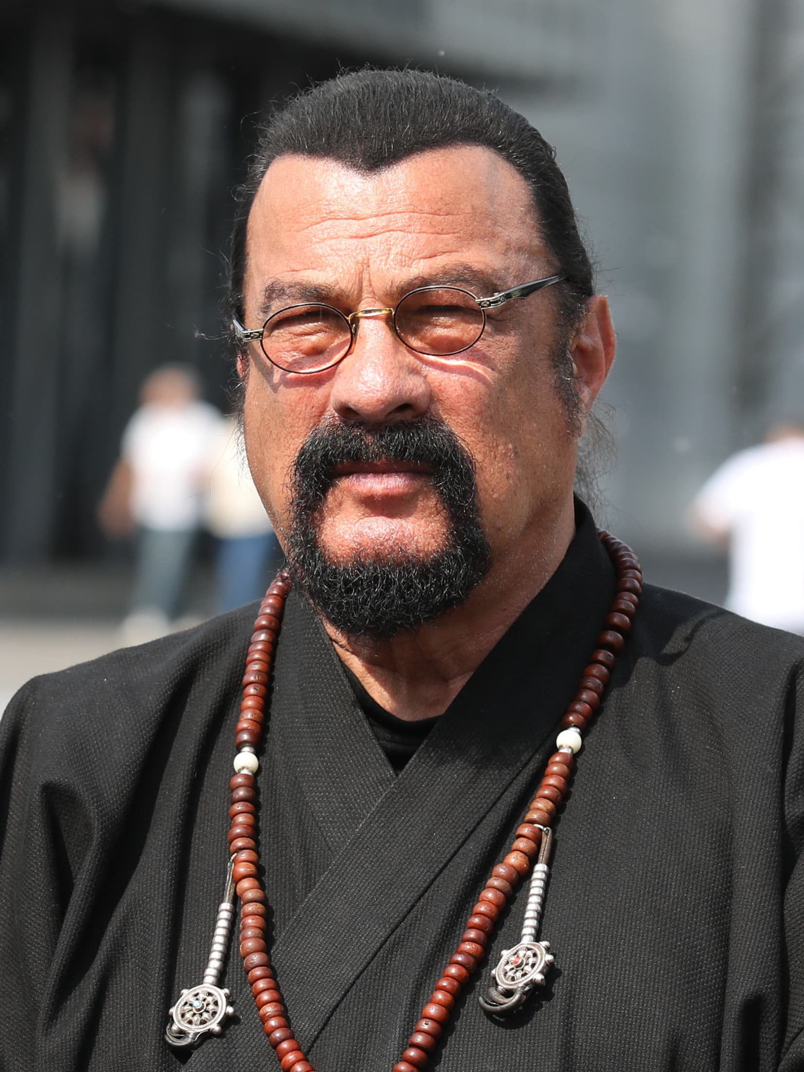 Steven Seagal - Actor hair transplant