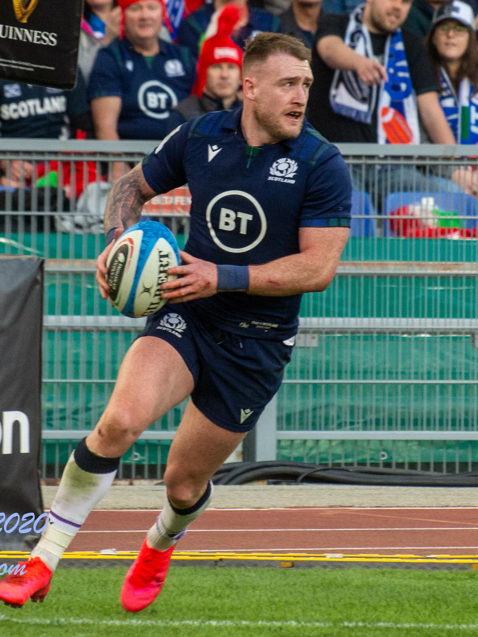 Stuart Hogg - Athlete hair transplant