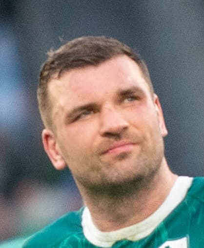 Tadhg Beirne - Athlete hair transplant