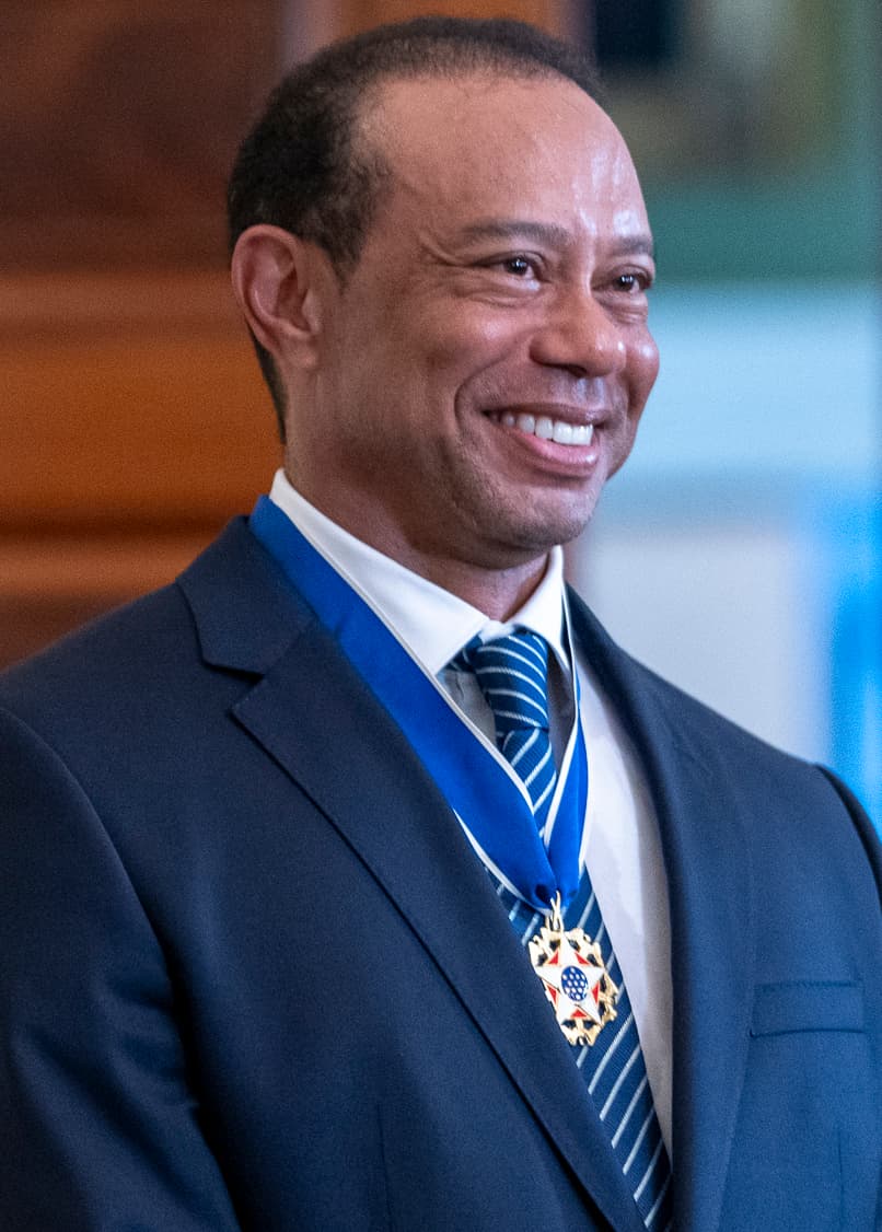 Tiger Woods - Athlete hair transplant