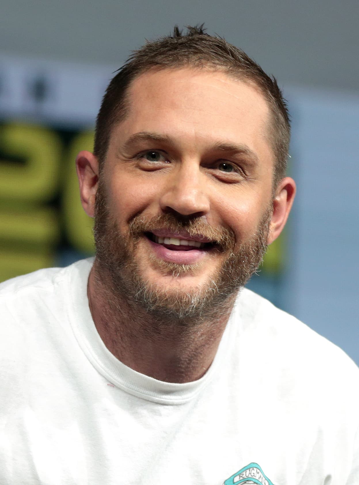 Tom Hardy - Actor hair transplant