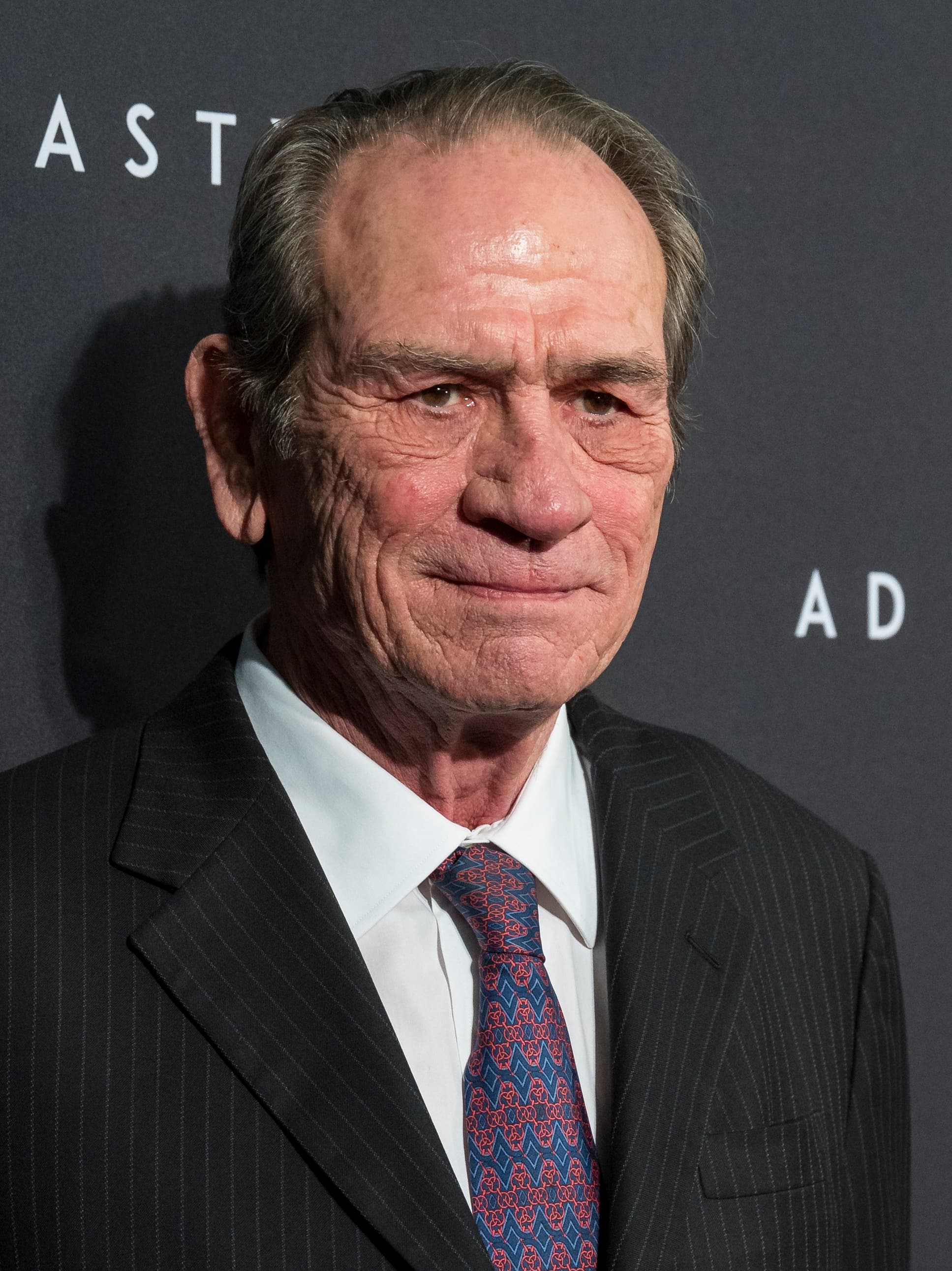 Tommy Lee Jones - Actor hair transplant