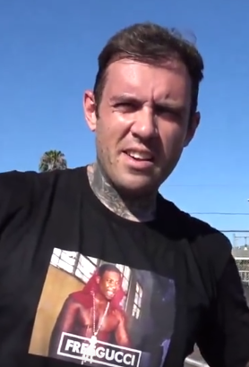 Adam Grandmaison aka Adam22 - Content Creator hair transplant