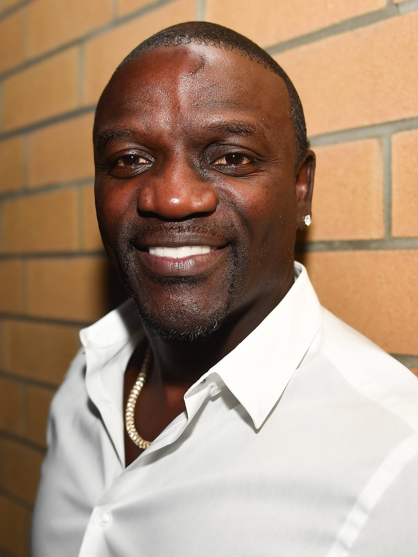 Akon - Musician with confirmed hair transplant