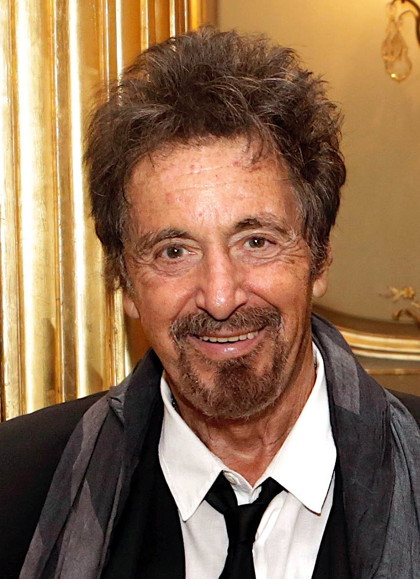 Al Pacino - Actor hair transplant
