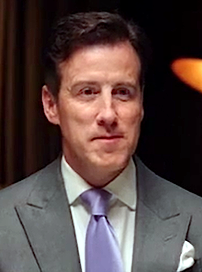 Anton du Beke - TV Personality with confirmed hair transplant