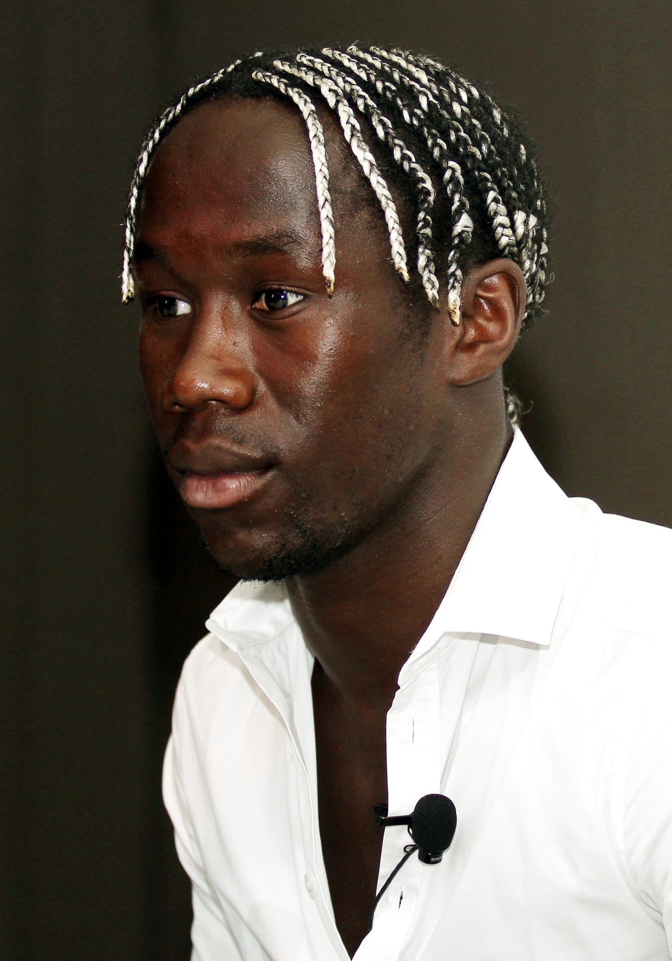 Bacary Sagna - Athlete hair transplant