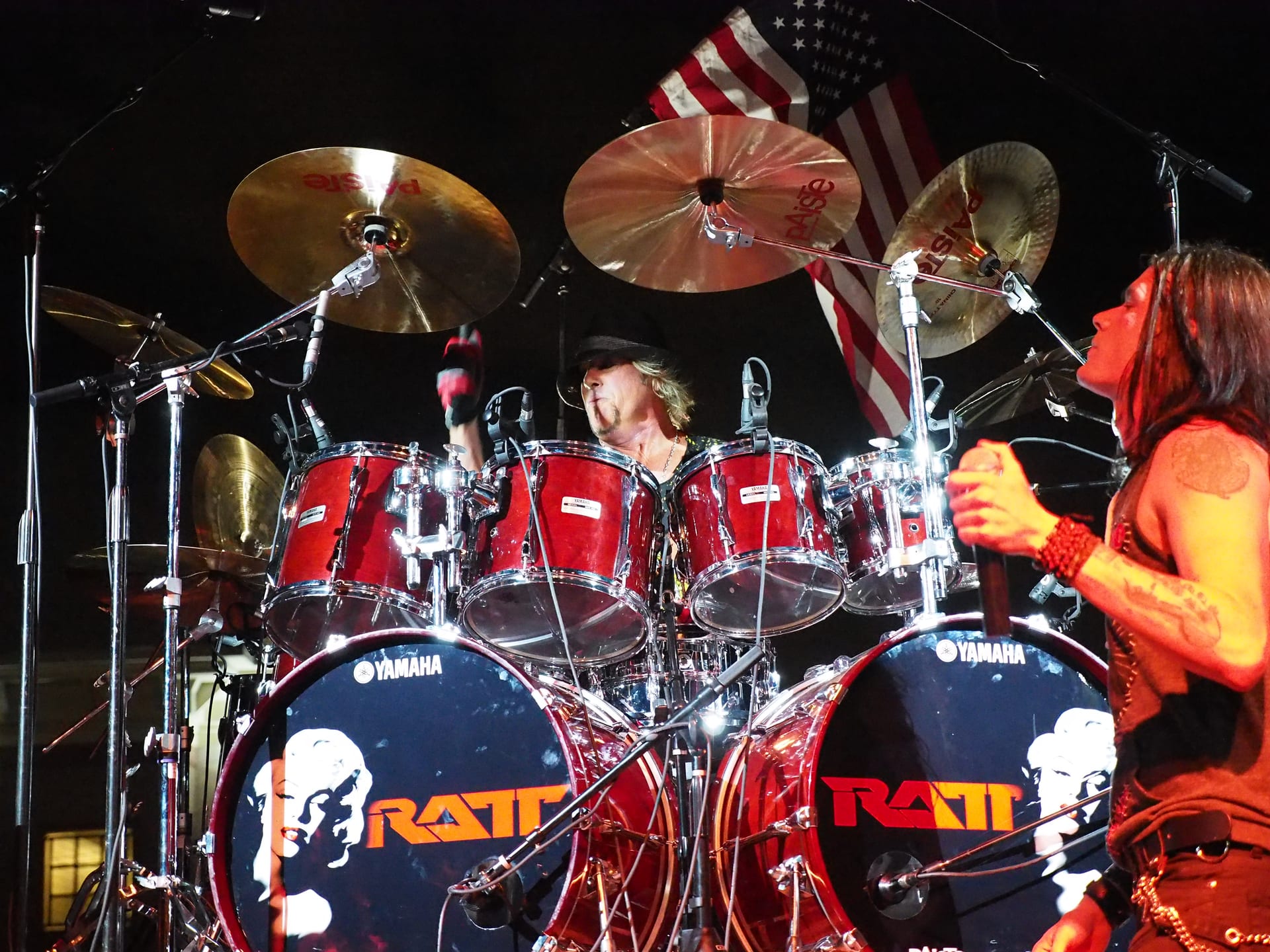Bobby Blotzer - Musician hair transplant