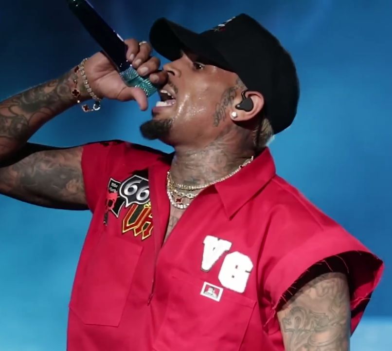 Chris Brown - Musician hair transplant