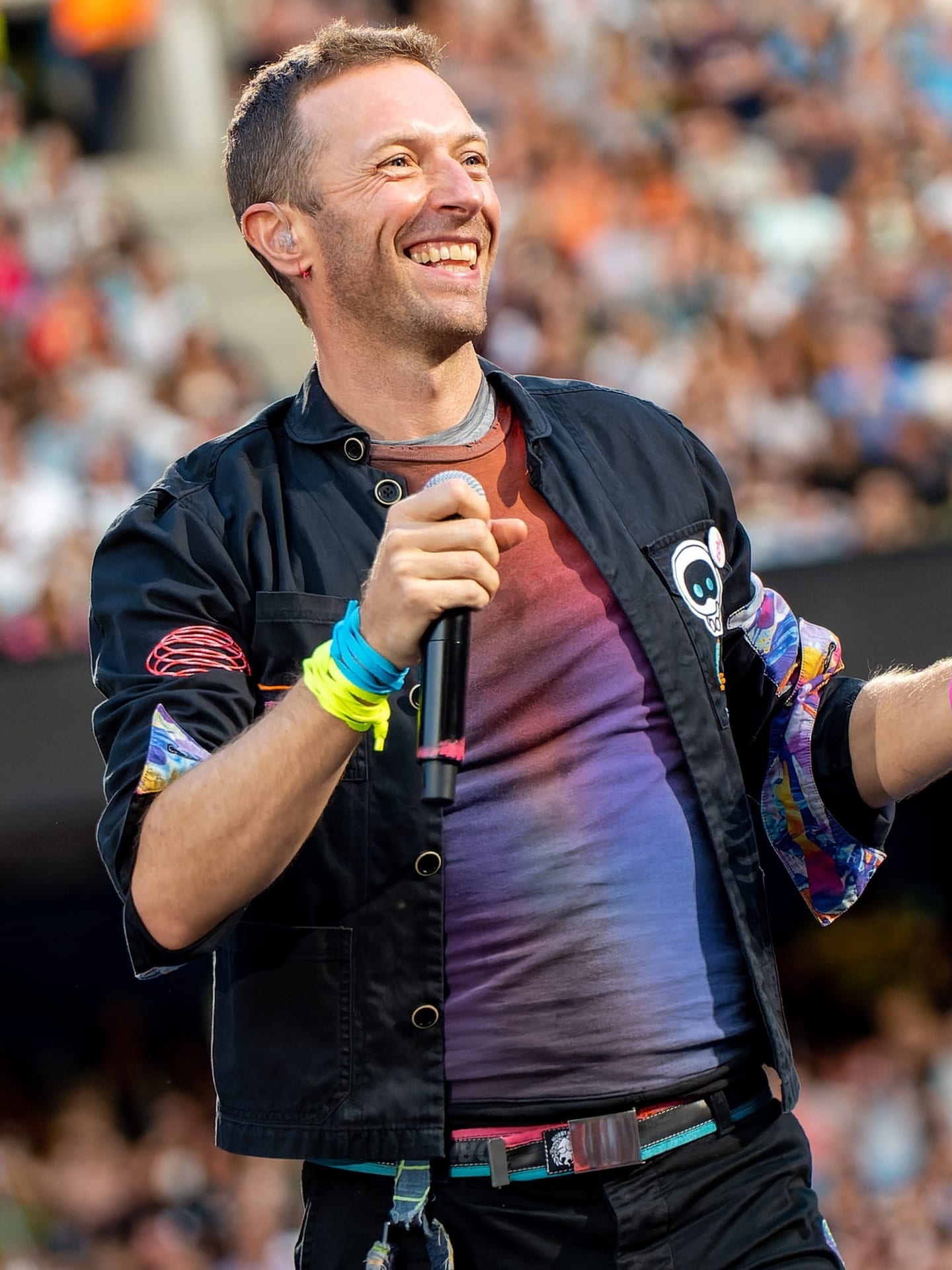 Chris Martin - Musician hair transplant