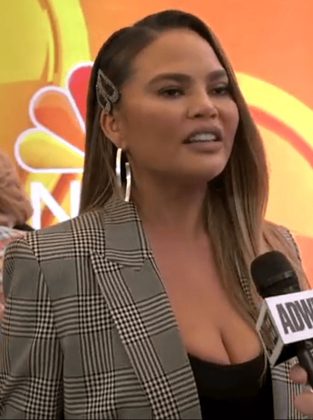 Chrissy Teigen - TV Personality hair transplant