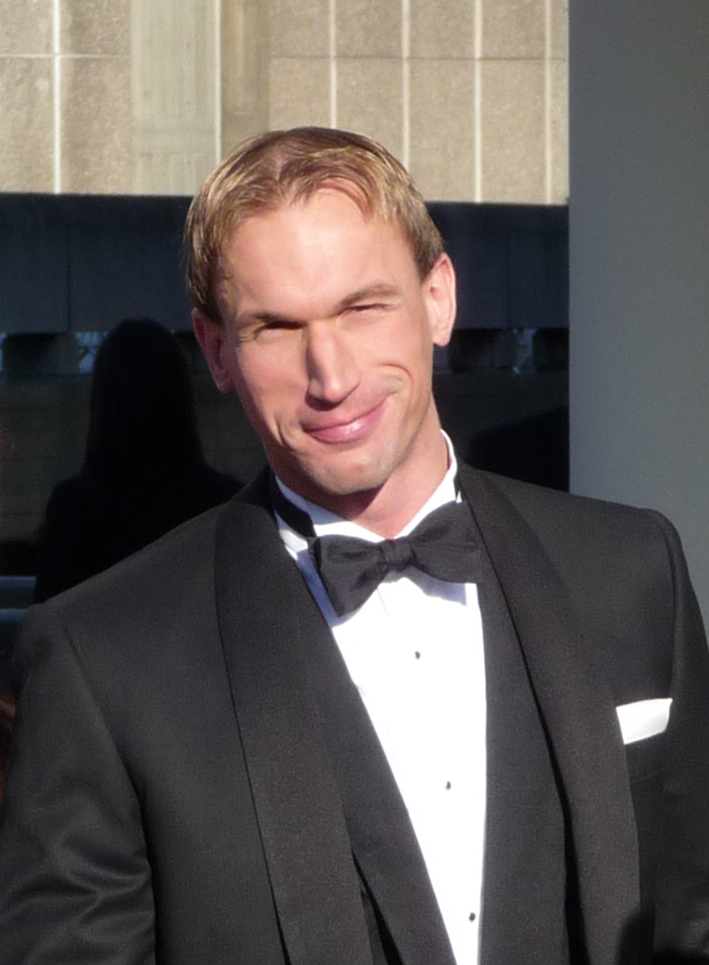 Christian Jessen - TV Personality hair transplant