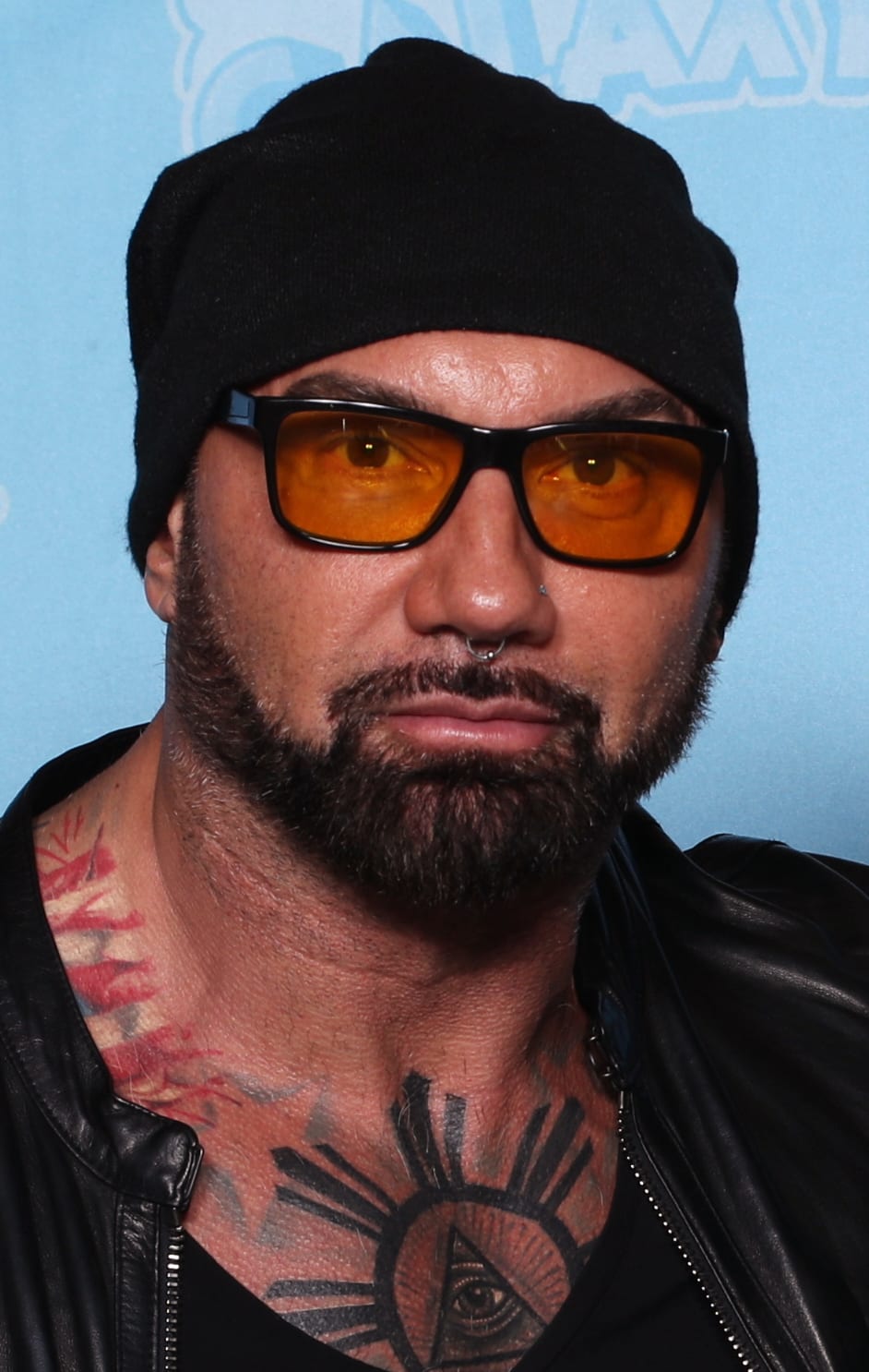 Dave Batista - Actor hair transplant