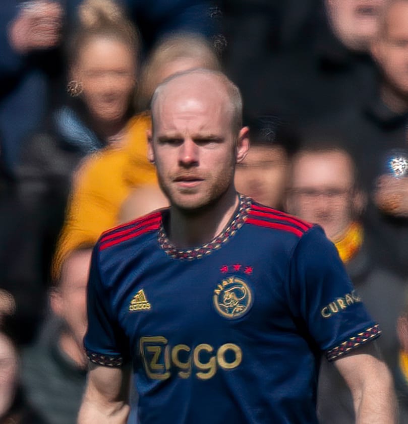 Davy Klaassen - Athlete hair transplant