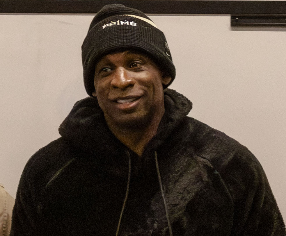 Deion Sanders - Athlete hair transplant