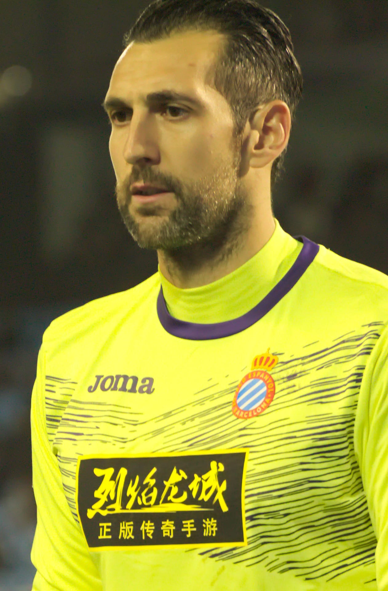 Diego López - Athlete hair transplant