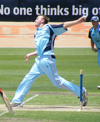 Doug Bollinger - Athlete hair transplant