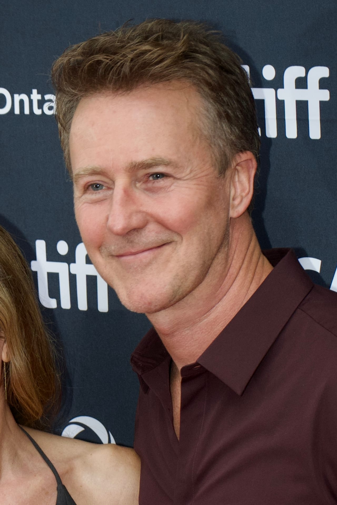 Edward Norton - Actor hair transplant