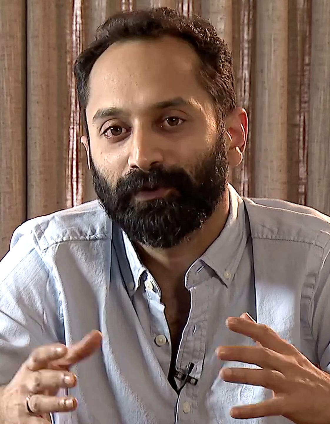 Fahadh Faasil - Actor hair transplant