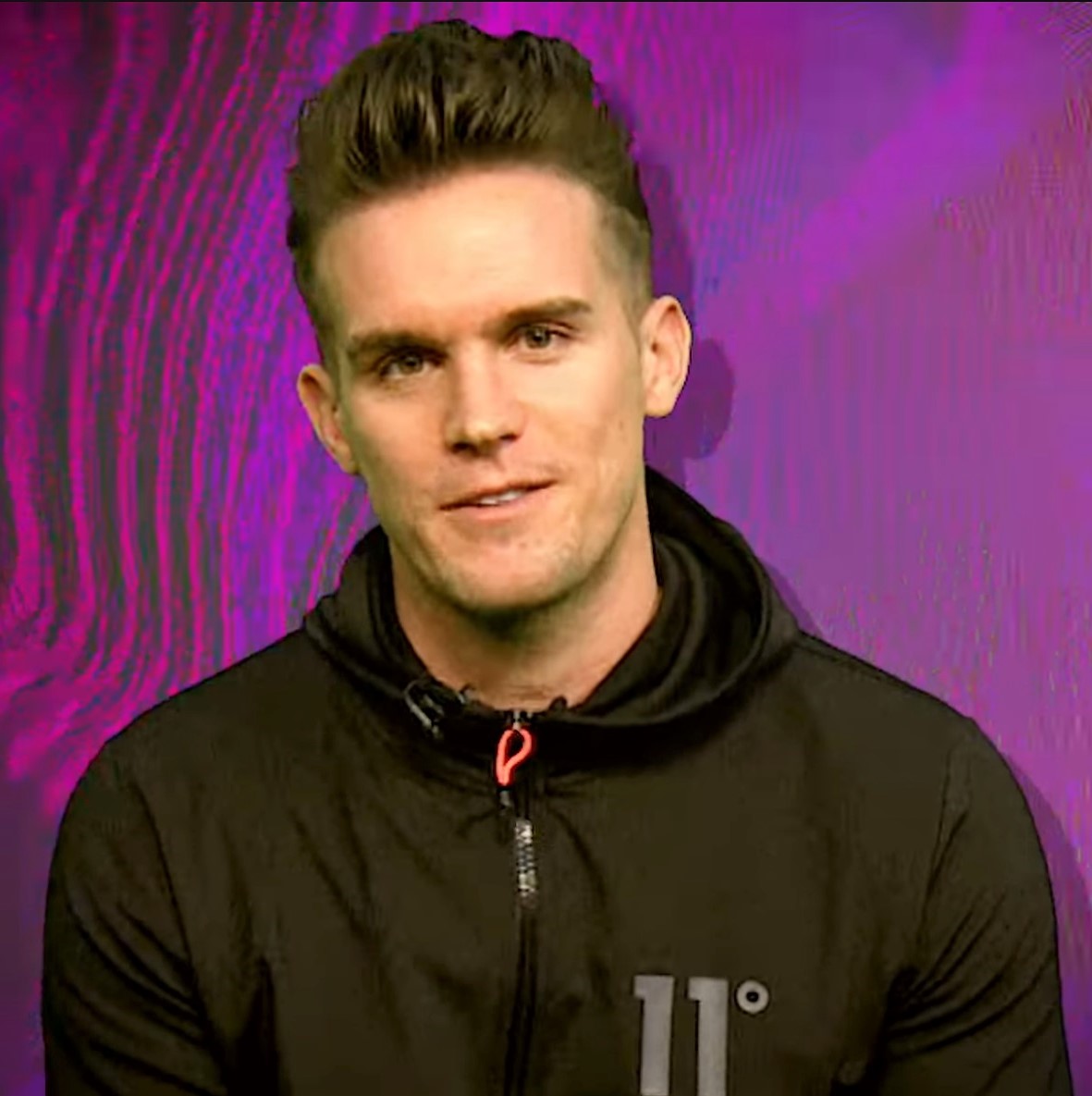 Gaz Beadle - TV Personality hair transplant