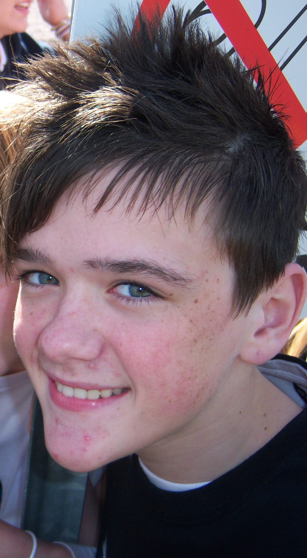 George Sampson - Actor with confirmed hair transplant